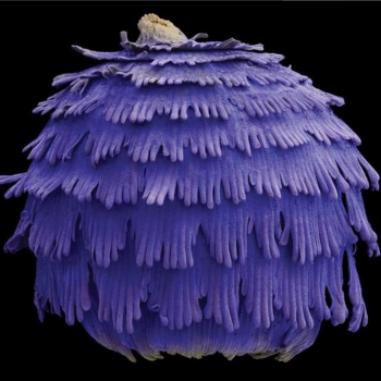 Пыльца под микроскопом от Роберта Кесселера.