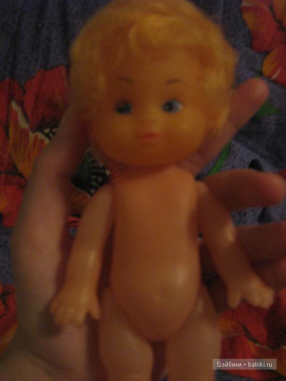 Моё детство и разбитый глаз :( (фото 5)