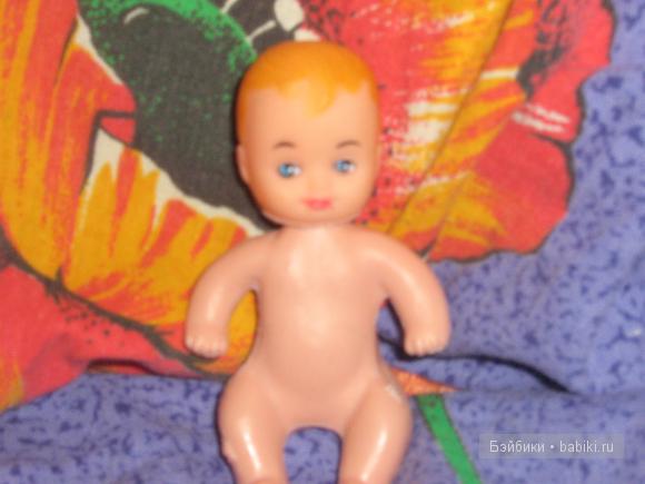 Моё детство и разбитый глаз :( (фото 6)