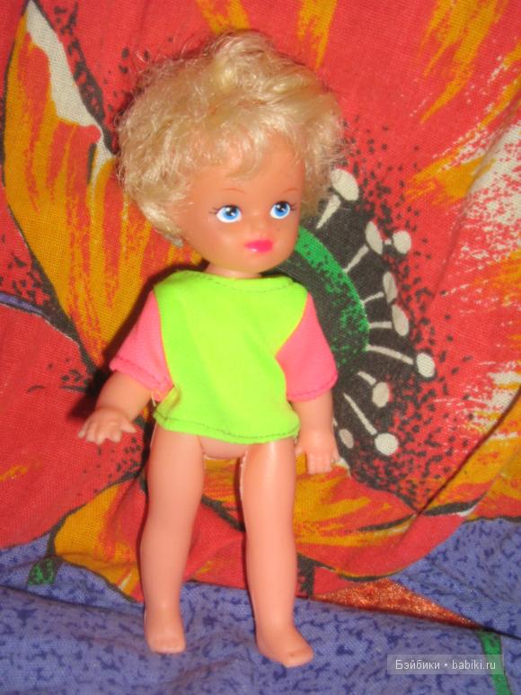 Моё детство и разбитый глаз :( (фото 7)