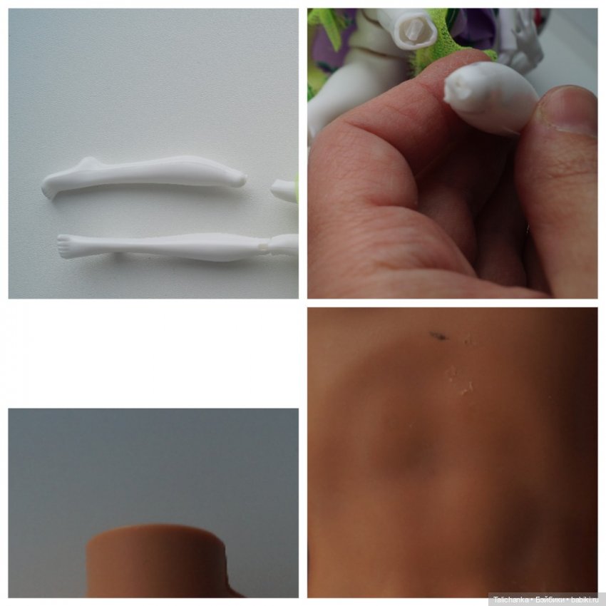 Третья мартовская выписка. Вылечено два перелома (фото 2)