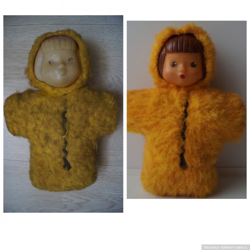 Третья мартовская выписка. Вылечено два перелома