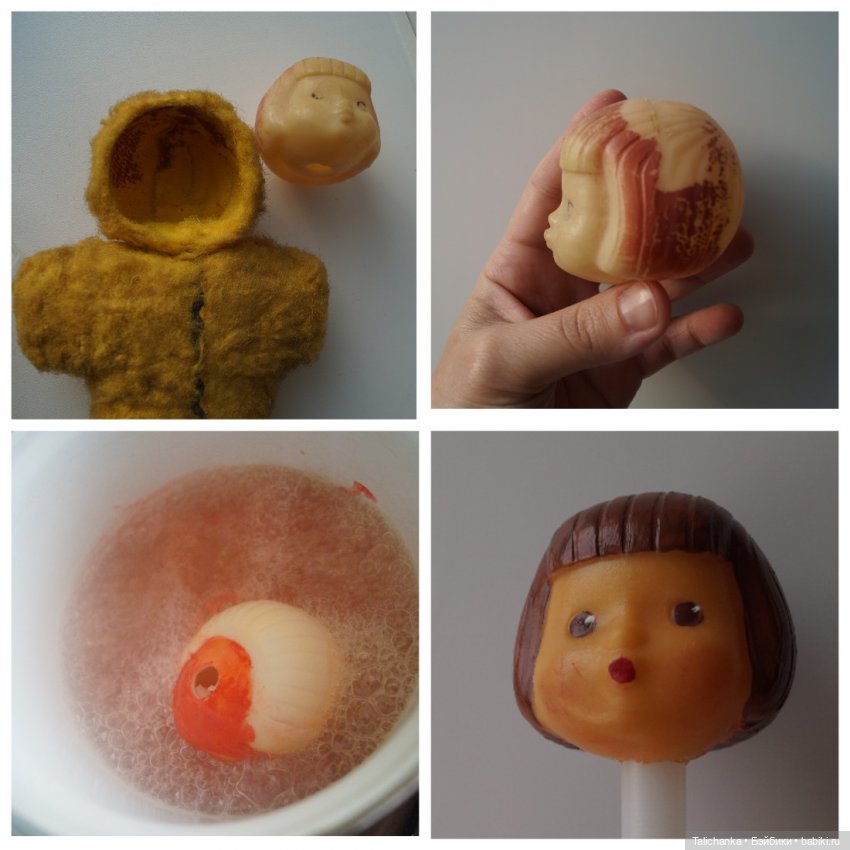 Третья мартовская выписка. Вылечено два перелома