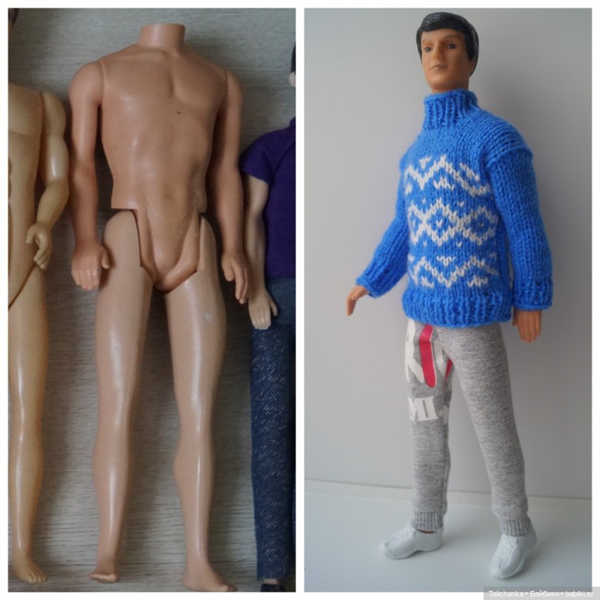 Третья мартовская выписка. Вылечено два перелома