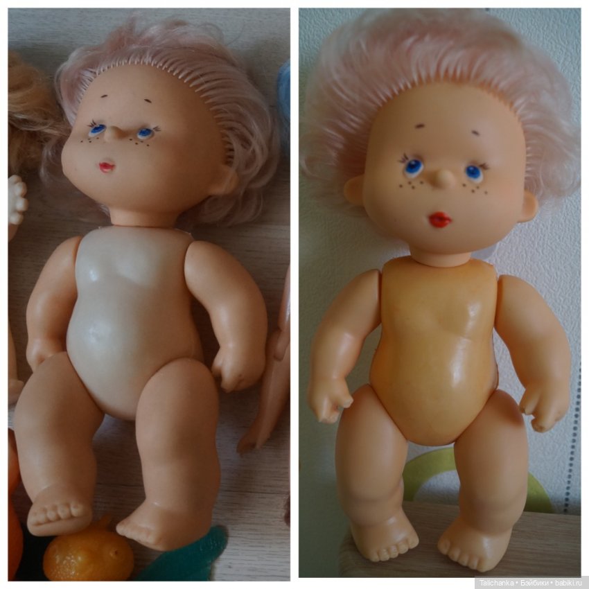 Четвёртая мартовская выписка. Машенька снова бегает и поёт! А перелом ноги исправлен за 10 минут