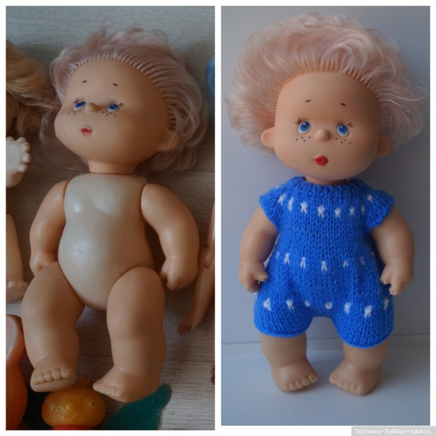 Четвёртая мартовская выписка. Машенька снова бегает и поёт! А перелом ноги исправлен за 10 минут