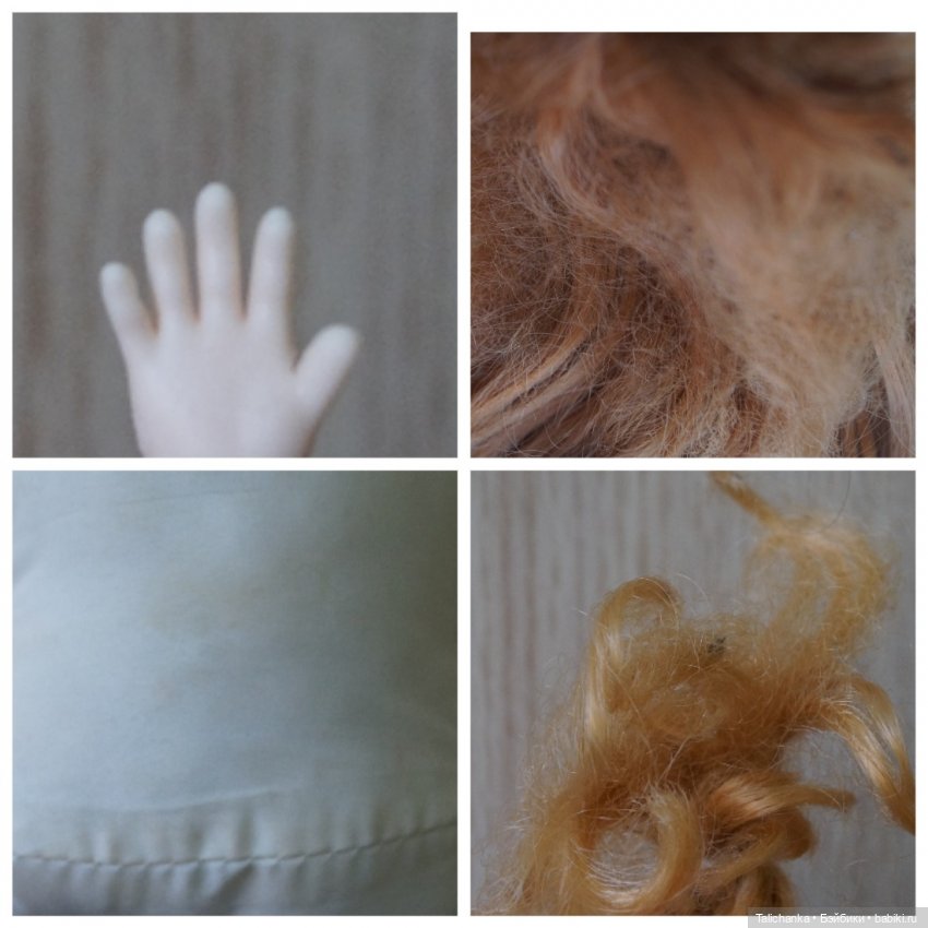 Четвёртая мартовская выписка. Машенька снова бегает и поёт! А перелом ноги исправлен за 10 минут