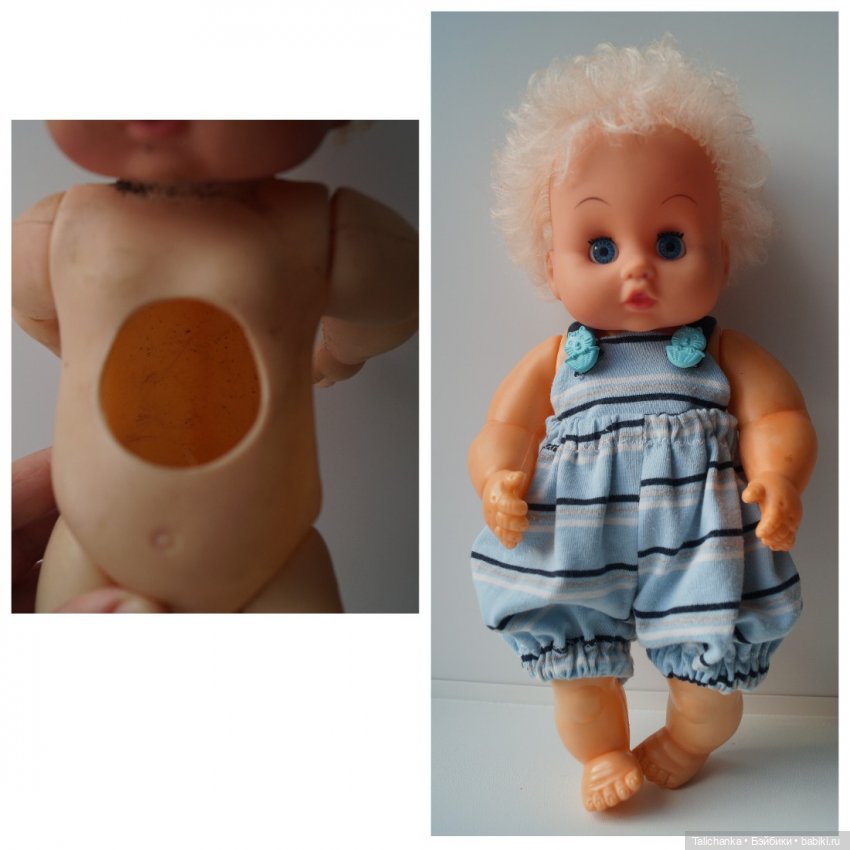 Четвёртая мартовская выписка. Машенька снова бегает и поёт! А перелом ноги исправлен за 10 минут