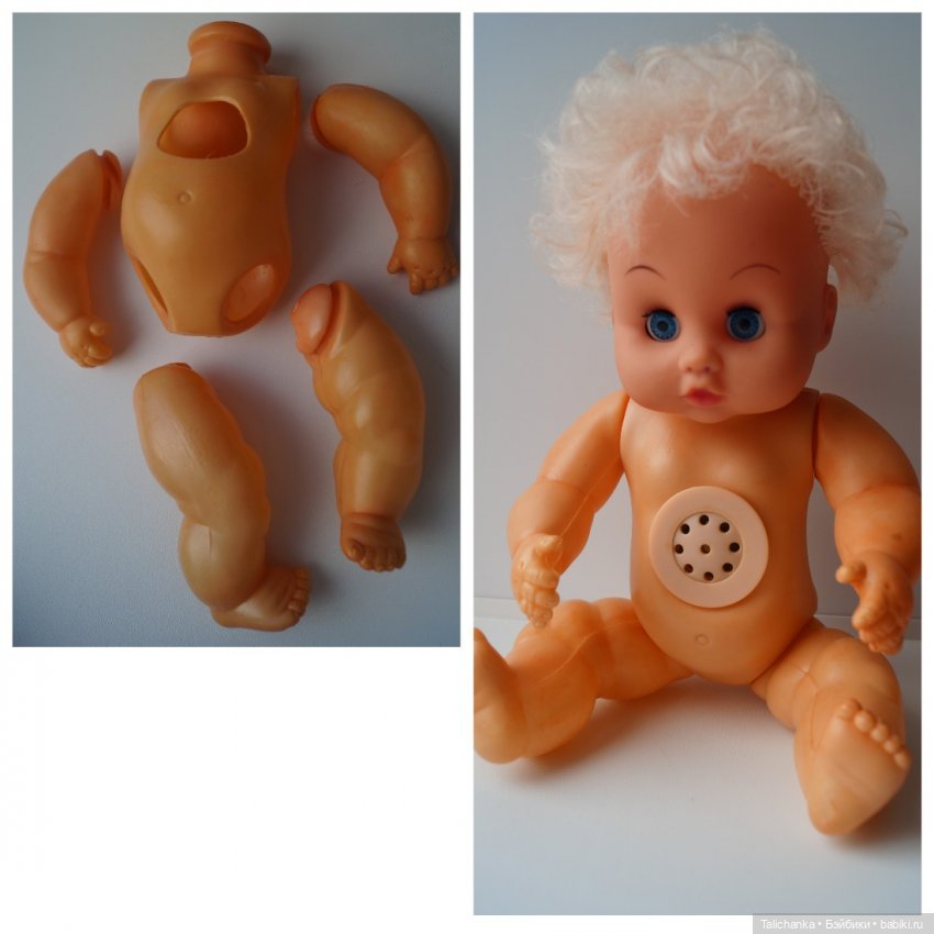 Четвёртая мартовская выписка. Машенька снова бегает и поёт! А перелом ноги исправлен за 10 минут