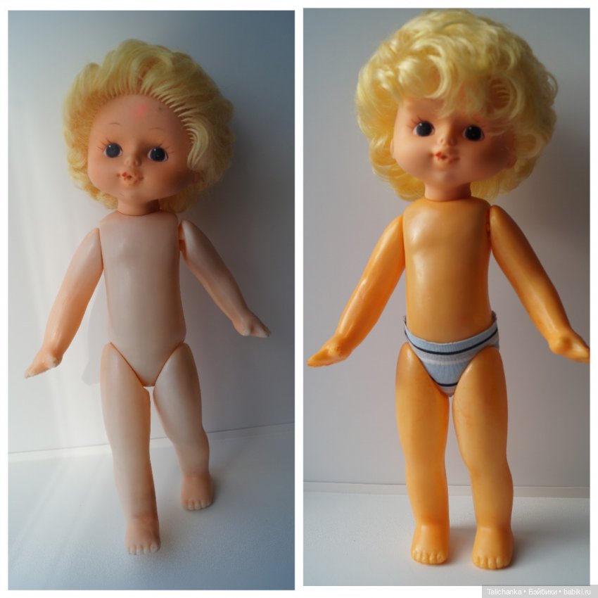 Четвёртая мартовская выписка. Машенька снова бегает и поёт! А перелом ноги исправлен за 10 минут