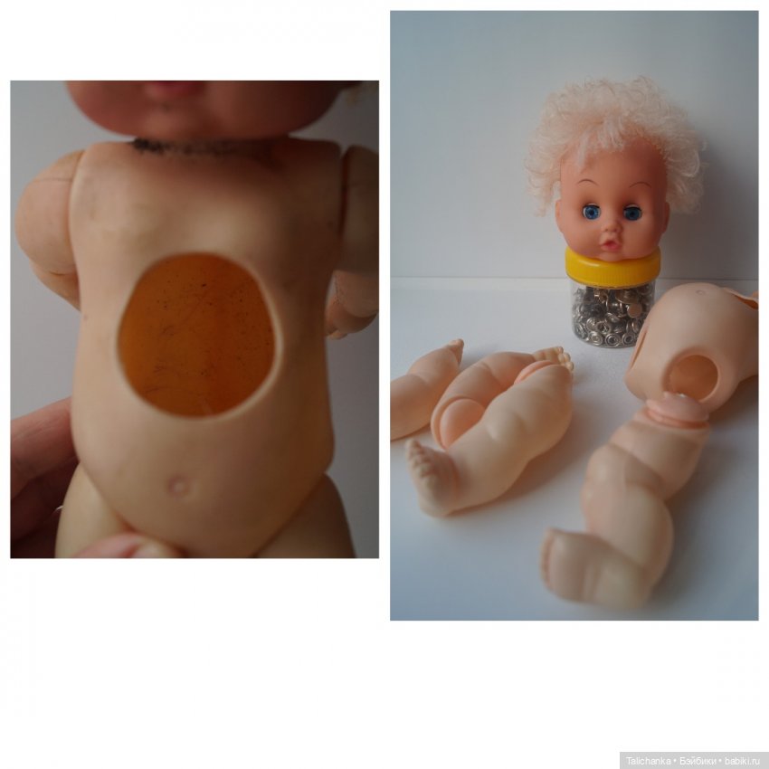 Четвёртая мартовская выписка. Машенька снова бегает и поёт! А перелом ноги исправлен за 10 минут