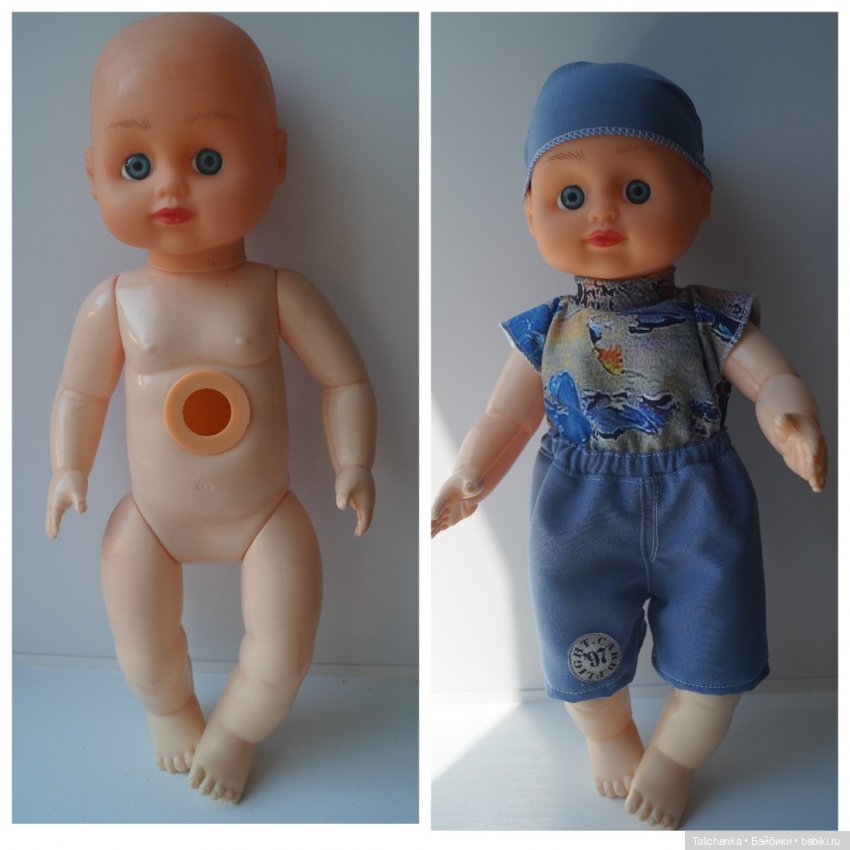 Вторая июльская выписка. Лечение глазок: отсутствие радужки, косоглазие. На лечении была ГДРочка. Голова+тело= красивая