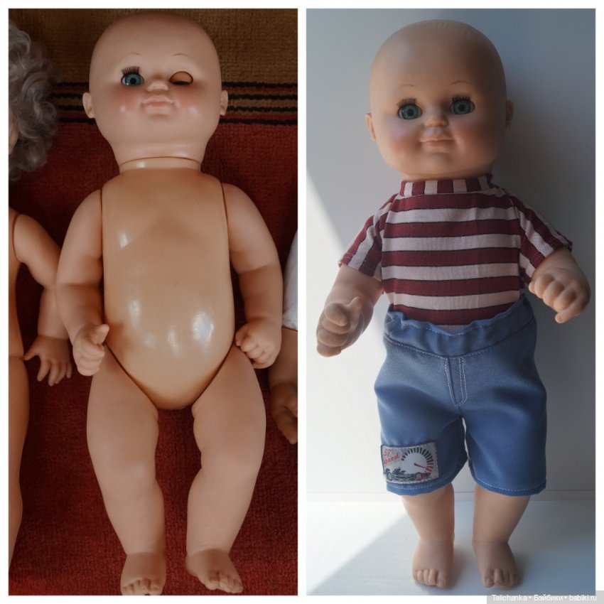 Вторая июльская выписка. Лечение глазок: отсутствие радужки, косоглазие. На лечении была ГДРочка. Голова+тело= красивая