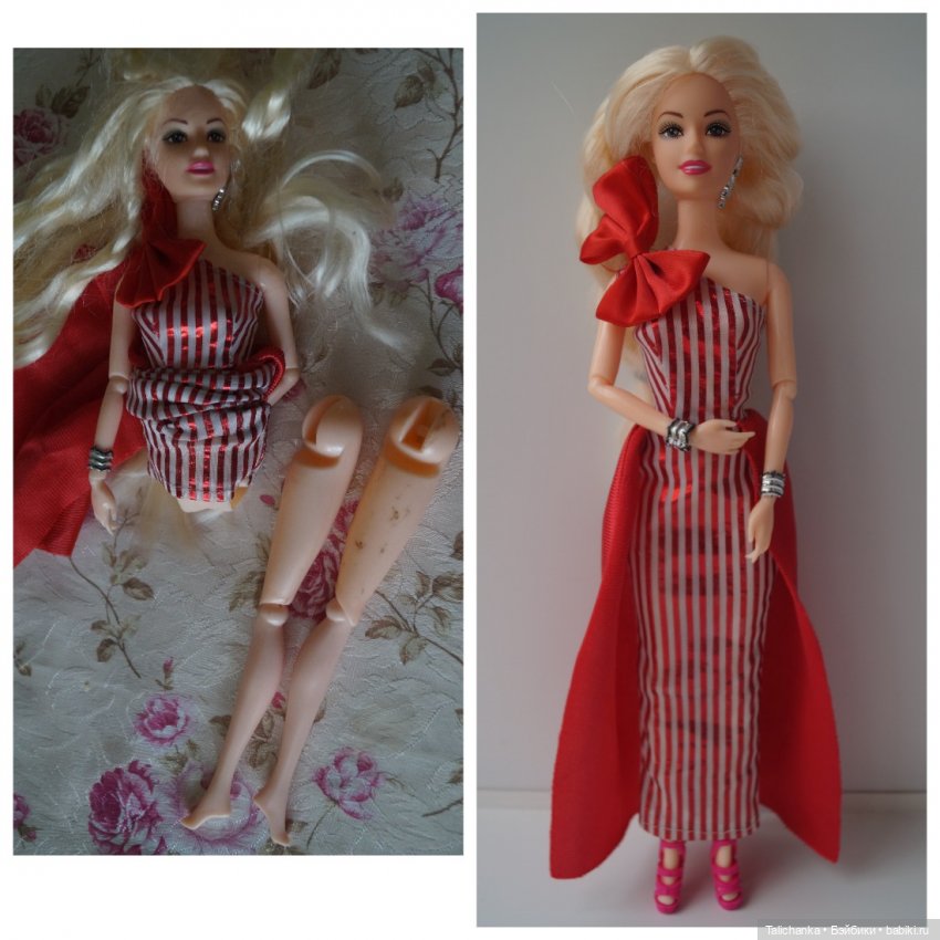 Вторая выписка сентября. Ещё одна поломка тазобедренных суставов и как её легко исправить