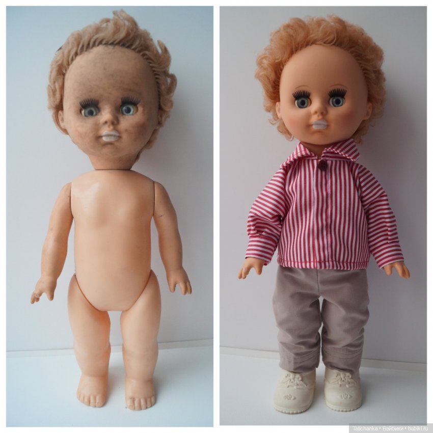 Третья выписка ноября. Лечим перелом колена, ставим донорские ручки. Анжелочка выздоровела + история-воспоминание о детском