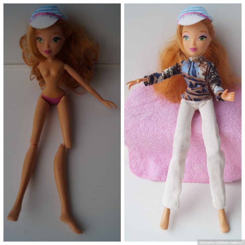 Третья выписка ноября. Лечим перелом колена, ставим донорские ручки. Анжелочка выздоровела + история-воспоминание о детском