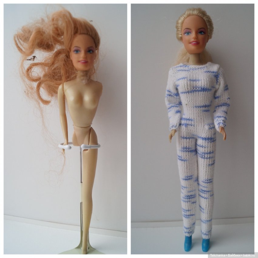 Вторая выписка декабря. Главная героиня нового года поправила своё здоровье. Лечим покусанные руки Барби, удаляем жир с