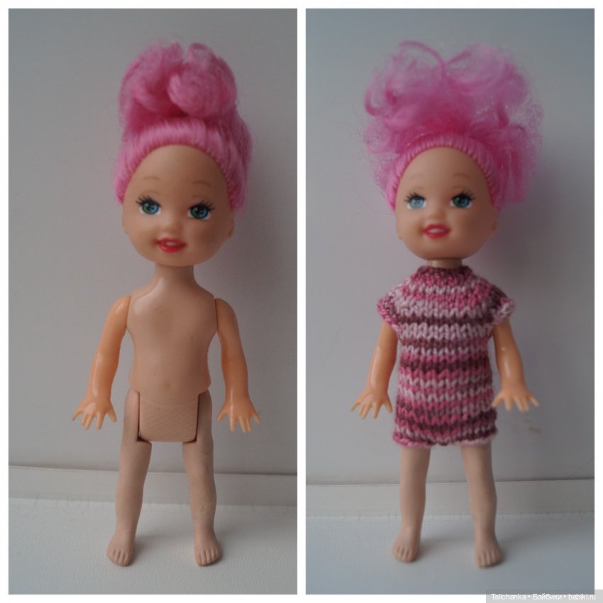 Вторая выписка декабря. Главная героиня нового года поправила своё здоровье. Лечим покусанные руки Барби, удаляем жир с