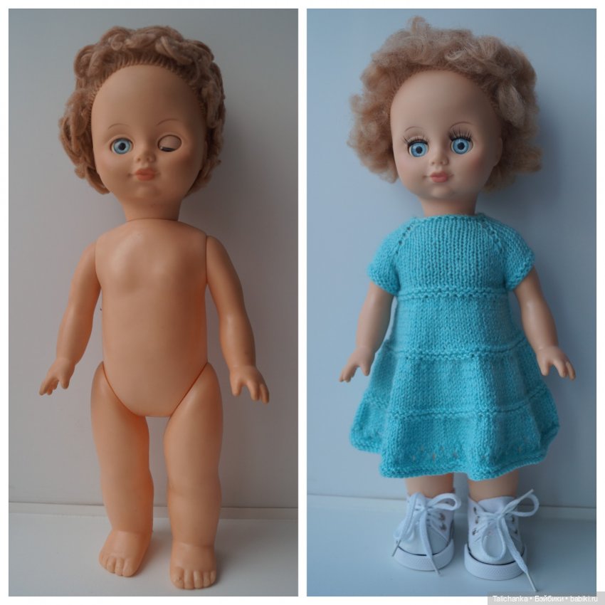 Вторая выписка января. Фарфоровая Снегурочка стала как новенькая. Зайчик снова видит. Как исправить западающий глазик у