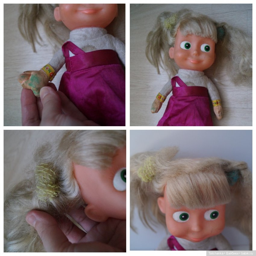 Вторая выписка марта. Нейрохирург вылечил девочку. Снова убираем банчемсы из волос Маши. Соединила голову и тело, получилась