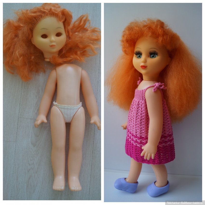 Вторая выписка июля. Перепрошивка, трессы вместо волос, починка перелома ноги беременной Штеффи+ бонус: фото из дома-музея