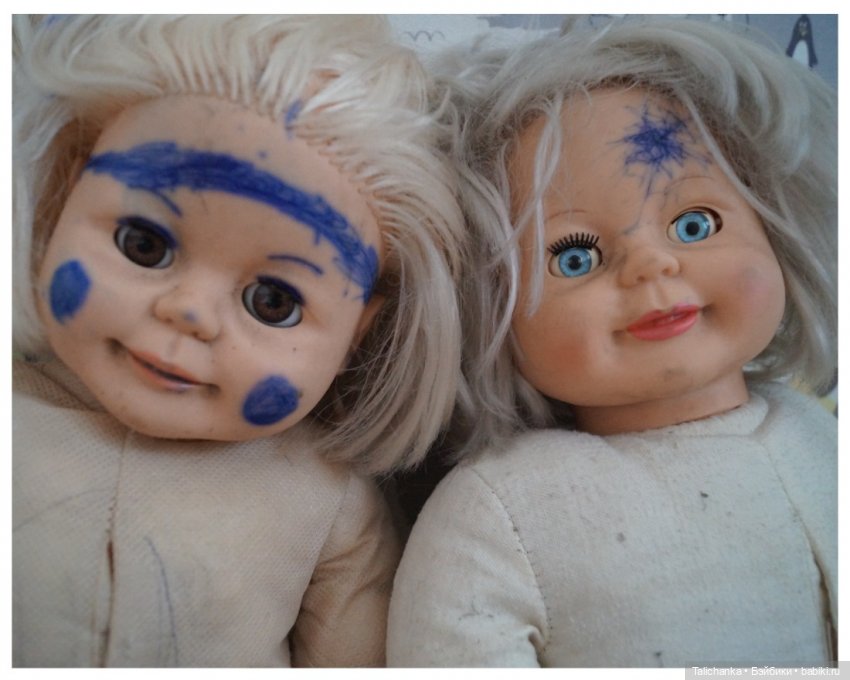 Третья выписка июля. Мишка здоров, лапки целы. Паяем плечико донецкому Илюше. Один Егорка от Весны здоров