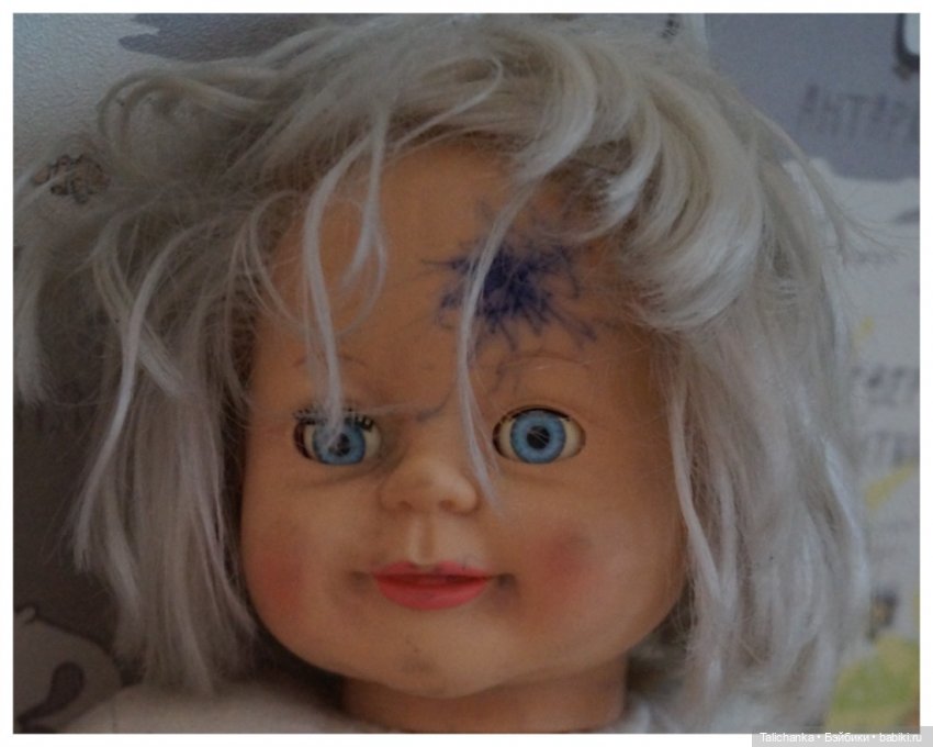 Третья выписка июля. Мишка здоров, лапки целы. Паяем плечико донецкому Илюше. Один Егорка от Весны здоров