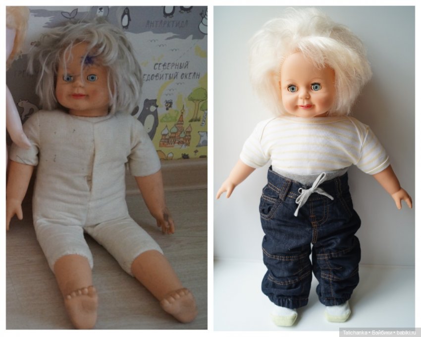 Третья выписка июля. Мишка здоров, лапки целы. Паяем плечико донецкому Илюше. Один Егорка от Весны здоров