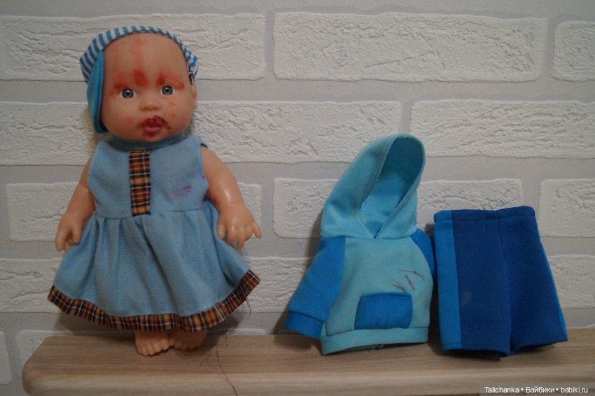 Вторая выписка октября. Как укрепить шею, когда голова заваливалась, ставим донорскую руку, прошиваем, обрабатываем паром и