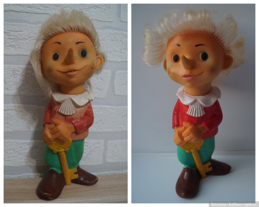 Вторая выписка октября. Как укрепить шею, когда голова заваливалась, ставим донорскую руку, прошиваем, обрабатываем паром и