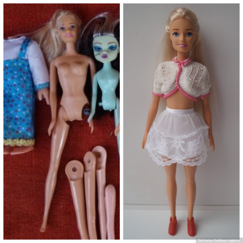 Вторая выписка октября. Как укрепить шею, когда голова заваливалась, ставим донорскую руку, прошиваем, обрабатываем паром и