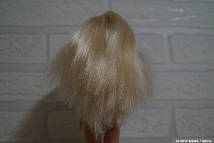 Вторая выписка октября. Как укрепить шею, когда голова заваливалась, ставим донорскую руку, прошиваем, обрабатываем паром и