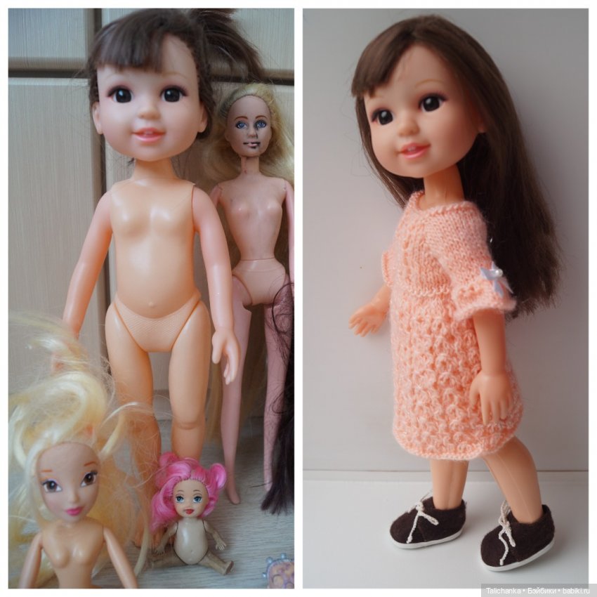 Вторая выписка октября. Как укрепить шею, когда голова заваливалась, ставим донорскую руку, прошиваем, обрабатываем паром и