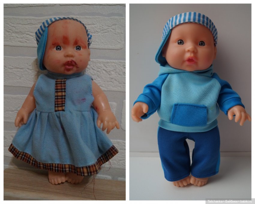 Вторая выписка октября. Как укрепить шею, когда голова заваливалась, ставим донорскую руку, прошиваем, обрабатываем паром и