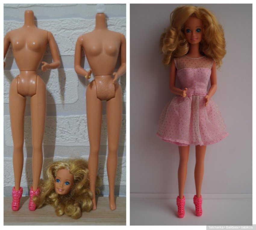 Вторая выписка октября. Как укрепить шею, когда голова заваливалась, ставим донорскую руку, прошиваем, обрабатываем паром и