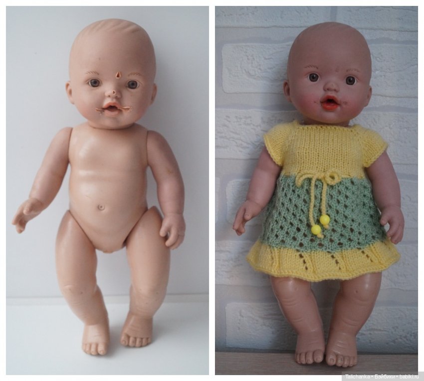 Третья выписка декабря. Сложный пациент с отсутствием волос, переломом тазобедренного сустава - вылечен. Как загладить ожоги на лице куклы | Бэйбики Третья выписка декабря. Сложный пациент с отсутствием волос, переломом тазобедренного сустава - вылечен. Как загладить ожоги