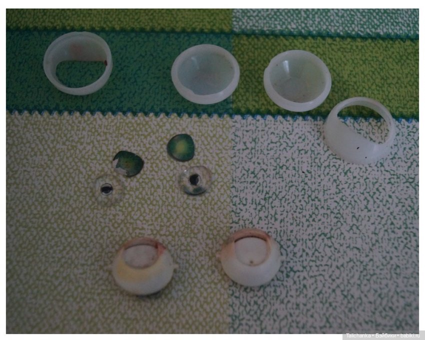 Пятая выписка декабря. Новогодний герой лечился у нейрохирурга. Починка шеи, как приклеить отпавшие кусочки. Прошивка волос