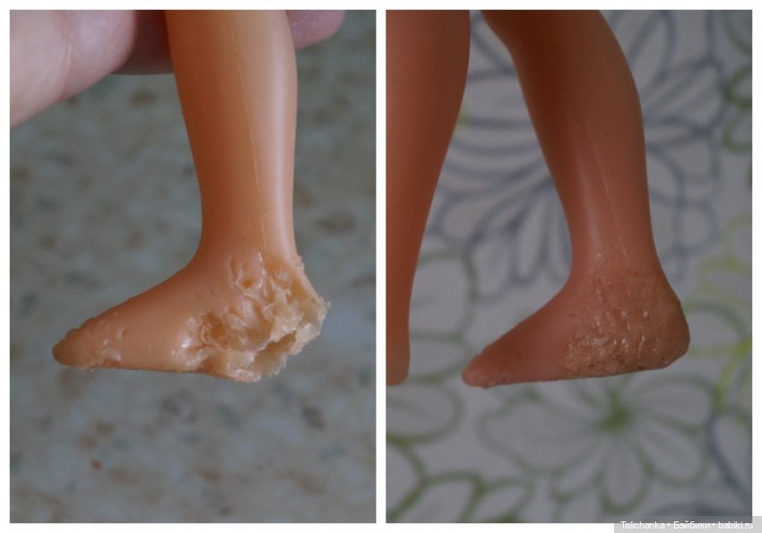 Третья выписка февраля. Паяю пяточку, которую сгрыз зверёк. Восстанавливаю волосы. Пеппи Длинныйчулок выздоровела