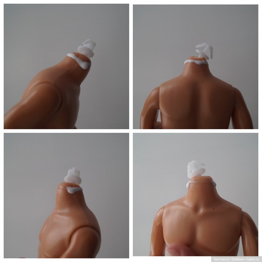 Четвёртая выписка февраля. Чисто мужская выписка. Как закрепить голову, которая заваливается на бок. Нейрохирург снова в