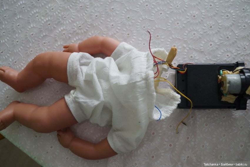 Четвёртая выписка февраля. Чисто мужская выписка. Как закрепить голову, которая заваливается на бок. Нейрохирург снова в