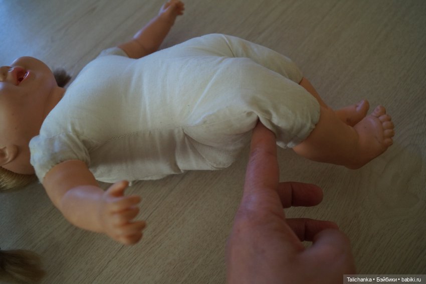 Вторая выписка августа. Вправляем тазобедренный перелом. Голова слоника превратилась в игрушку. Чиним шейный шанир (фото 7)