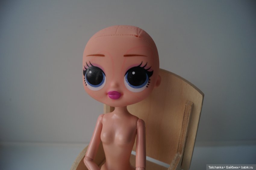 Третья выписка августа. Нейрохирург вылечил малюток. Вправляем тазобедренный вывих. Базироним гематомы и ссадины