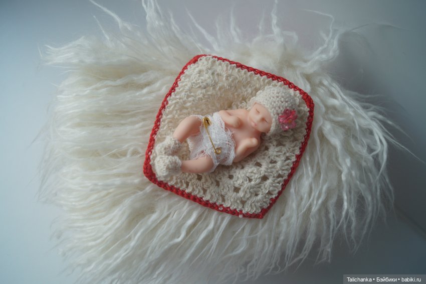 Третья выписка августа. Нейрохирург вылечил малюток. Вправляем тазобедренный вывих. Базироним гематомы и ссадины