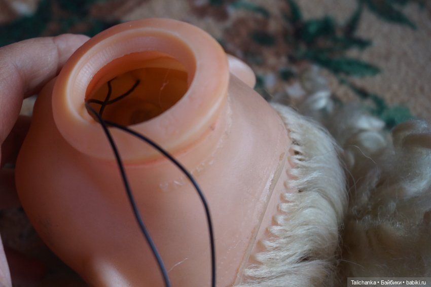 Третья выписка августа. Нейрохирург вылечил малюток. Вправляем тазобедренный вывих. Базироним гематомы и ссадины (фото 7)