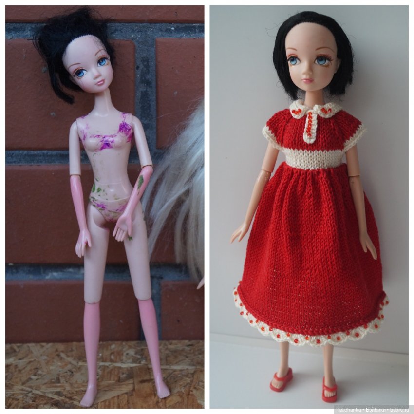 Третья выписка августа. Нейрохирург вылечил малюток. Вправляем тазобедренный вывих. Базироним гематомы и ссадины