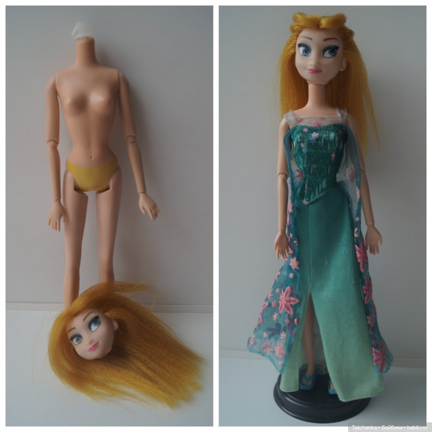 Третья выписка августа. Нейрохирург вылечил малюток. Вправляем тазобедренный вывих. Базироним гематомы и ссадины