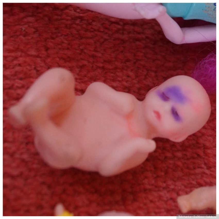 Третья выписка августа. Нейрохирург вылечил малюток. Вправляем тазобедренный вывих. Базироним гематомы и ссадины