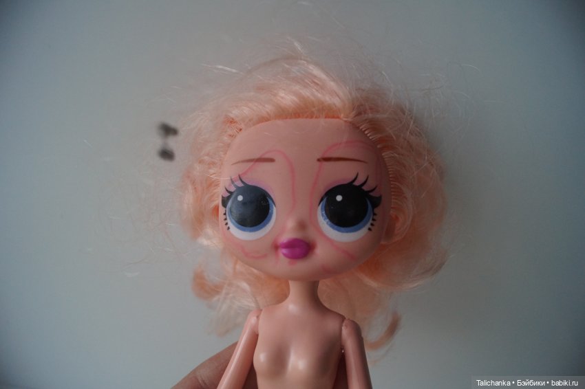 Третья выписка августа. Нейрохирург вылечил малюток. Вправляем тазобедренный вывих. Базироним гематомы и ссадины