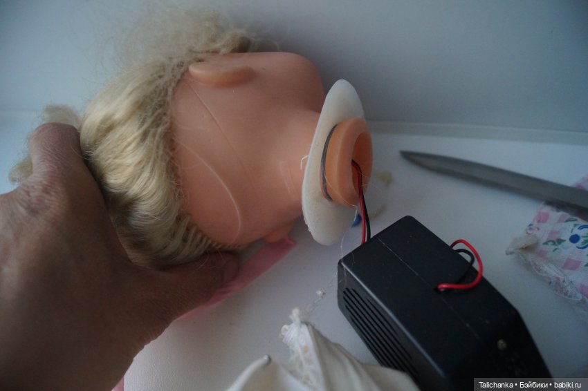 Третья выписка августа. Нейрохирург вылечил малюток. Вправляем тазобедренный вывих. Базироним гематомы и ссадины