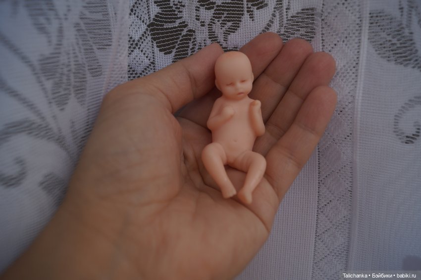 Третья выписка августа. Нейрохирург вылечил малюток. Вправляем тазобедренный вывих. Базироним гематомы и ссадины